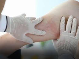 Pediatric or Medicine/Pediatric Allergist