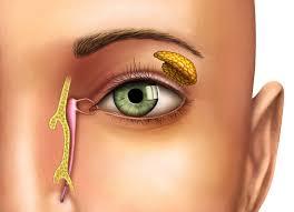 Oculoplastic Surgeon
