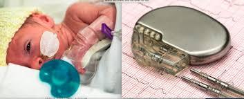 PEDIATRIC ELECTROPHYSIOLOGY