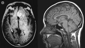 Neuro-Oncology Physician