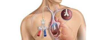 Nephrologist